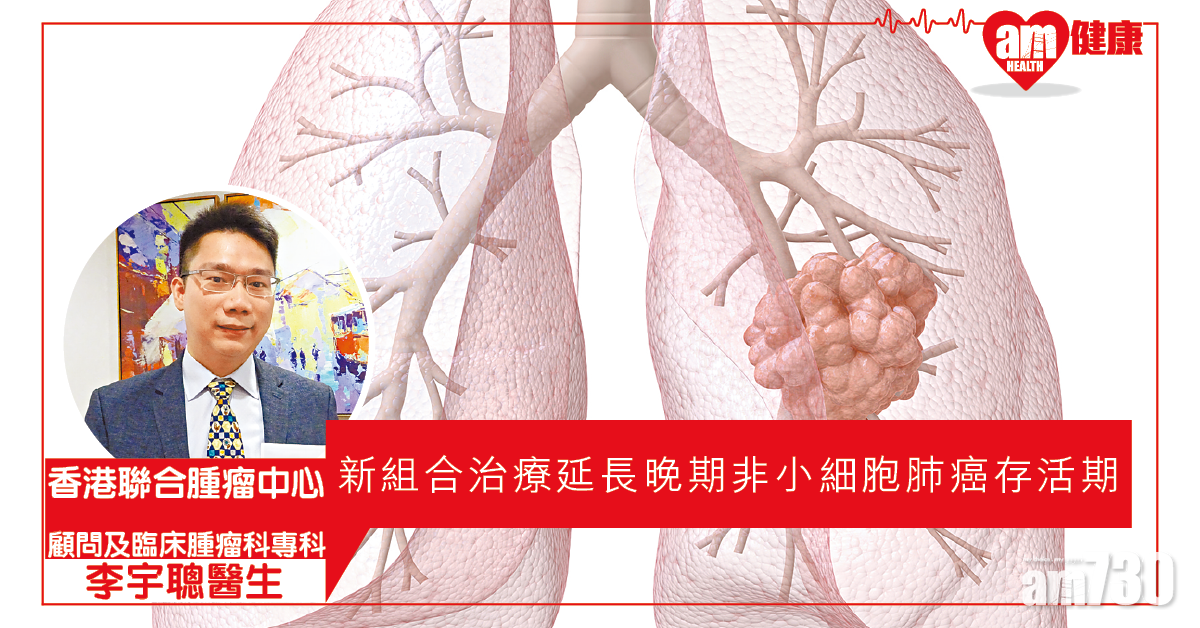 免疫治療配合化療、標靶藥  晚期肺癌延長存活期