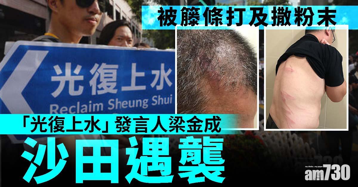 「光復上水」梁金成沙田遇襲  被籐條打及撒粉末