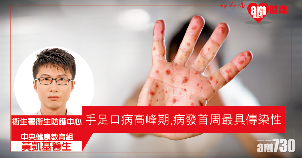 保持衛生 遠離手足口病