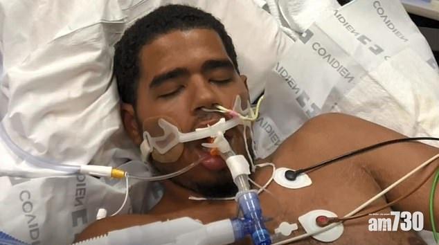 【第6宗死亡個案】美21歲大學生吸電子煙數年 肺衰竭亡