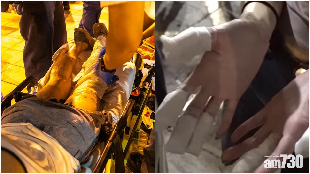 鴨脷洲邨狂徒疑擲腐液6人傷5人送院