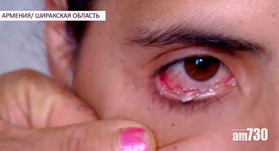 22歲女流「水晶眼淚」 每日50多顆 (有片)