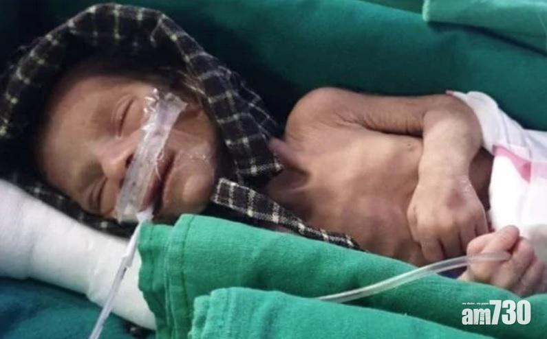 【冥冥之中】商人喪女心碎挖墳埋葬　竟救出被埋活女嬰