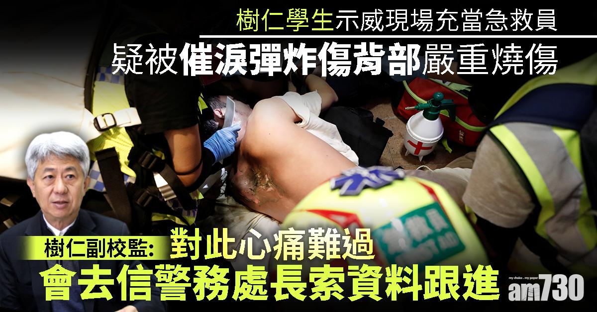 對同學嚴重燒傷感難過　樹仁副校監：去信警務處長索資料跟進