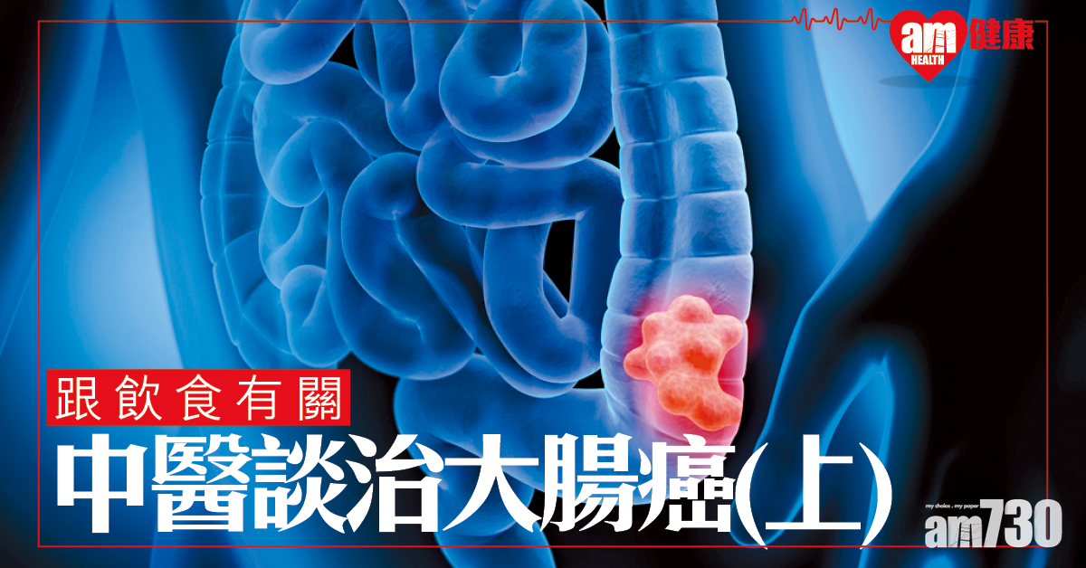中醫治療大腸癌(上)