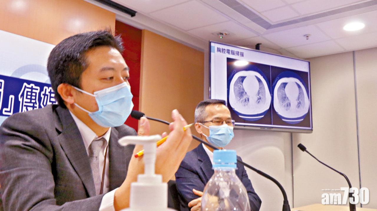 副作用強「瑞德西韋」 僅宜針對中至重症