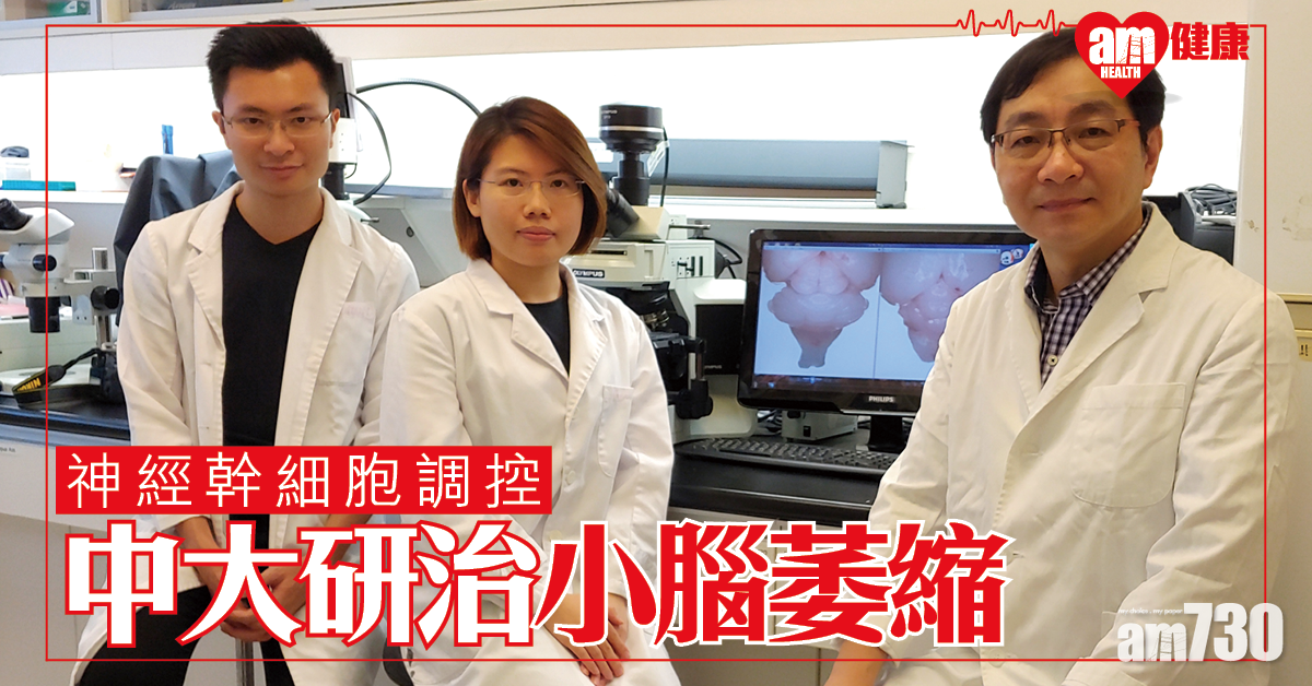 【再生醫學】中大發現神經幹細胞調控機制 助研相關疾病治療