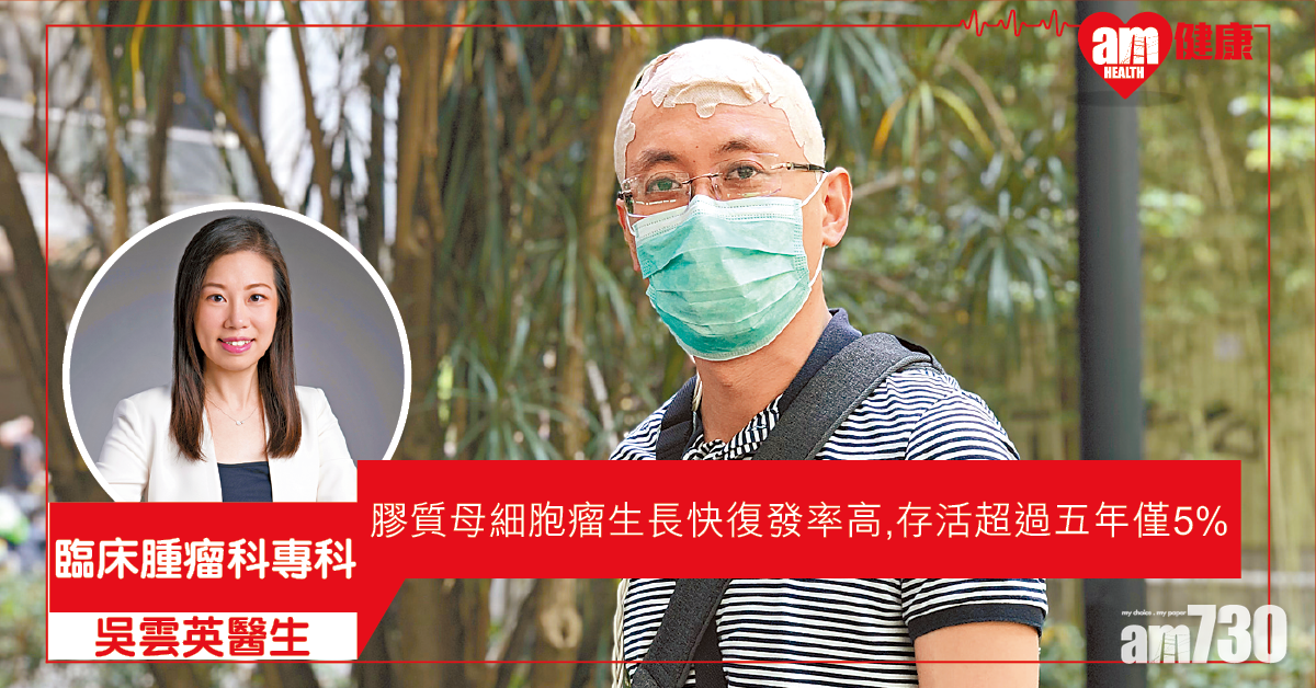 腫瘤電場治療 積極面對腦癌