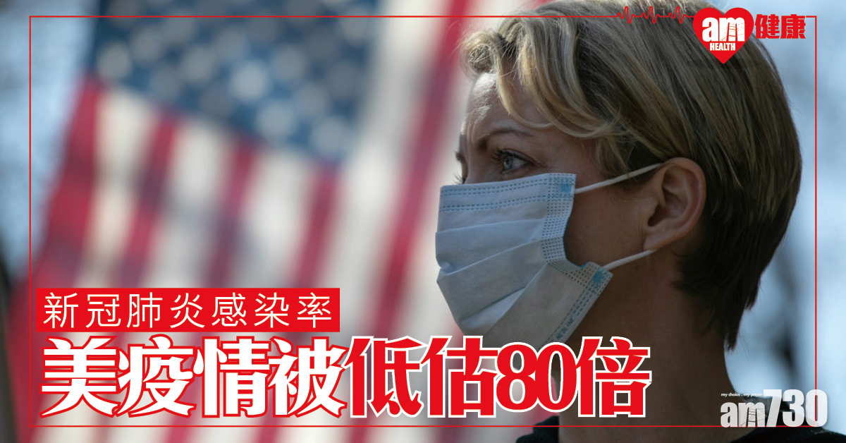 【新冠肺炎】忽略早期疑似病例 研究指美感染率被低估80倍