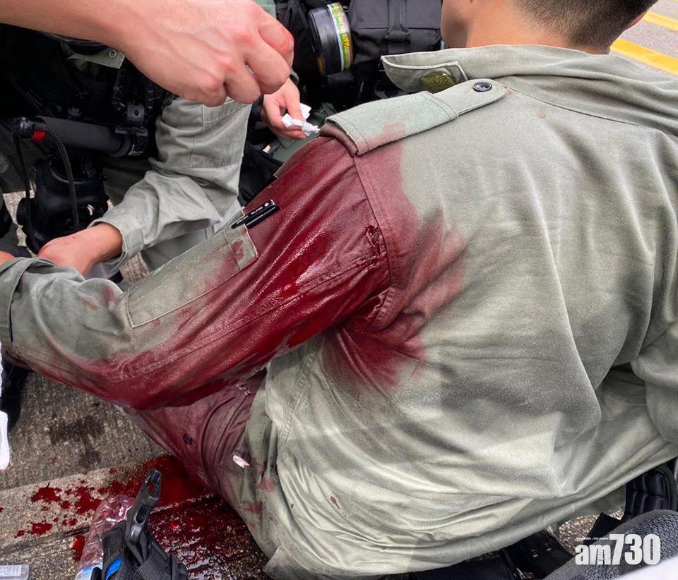 【港區國安法】銅鑼灣警遭刺傷搶犯 疑犯逃脫