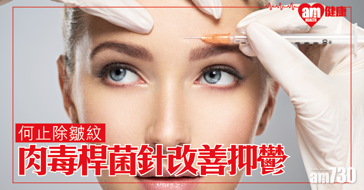 何止除皺紋？研究指肉毒桿菌針助改善抑鬱