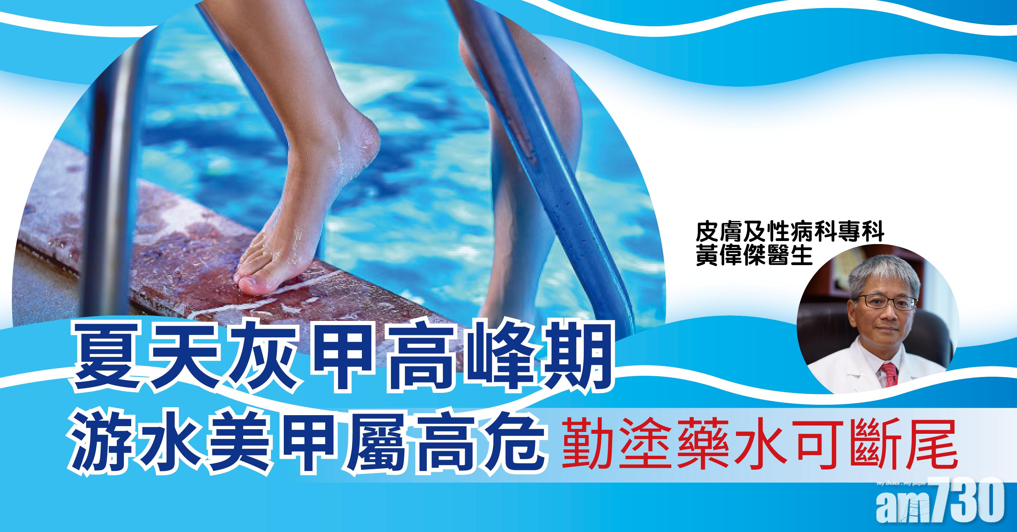 健康快訊：灰甲治療新趨勢 勤塗藥水可斷尾