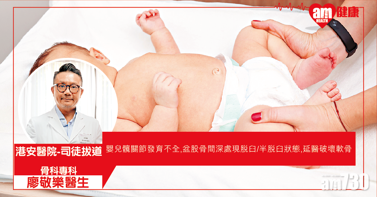 髖關節發育不全 愈早醫愈簡單