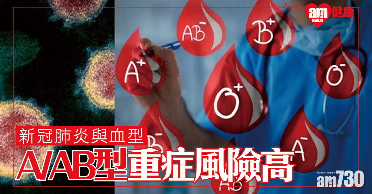 【新冠肺炎與血型】研究指A/AB型染疫重症風險高