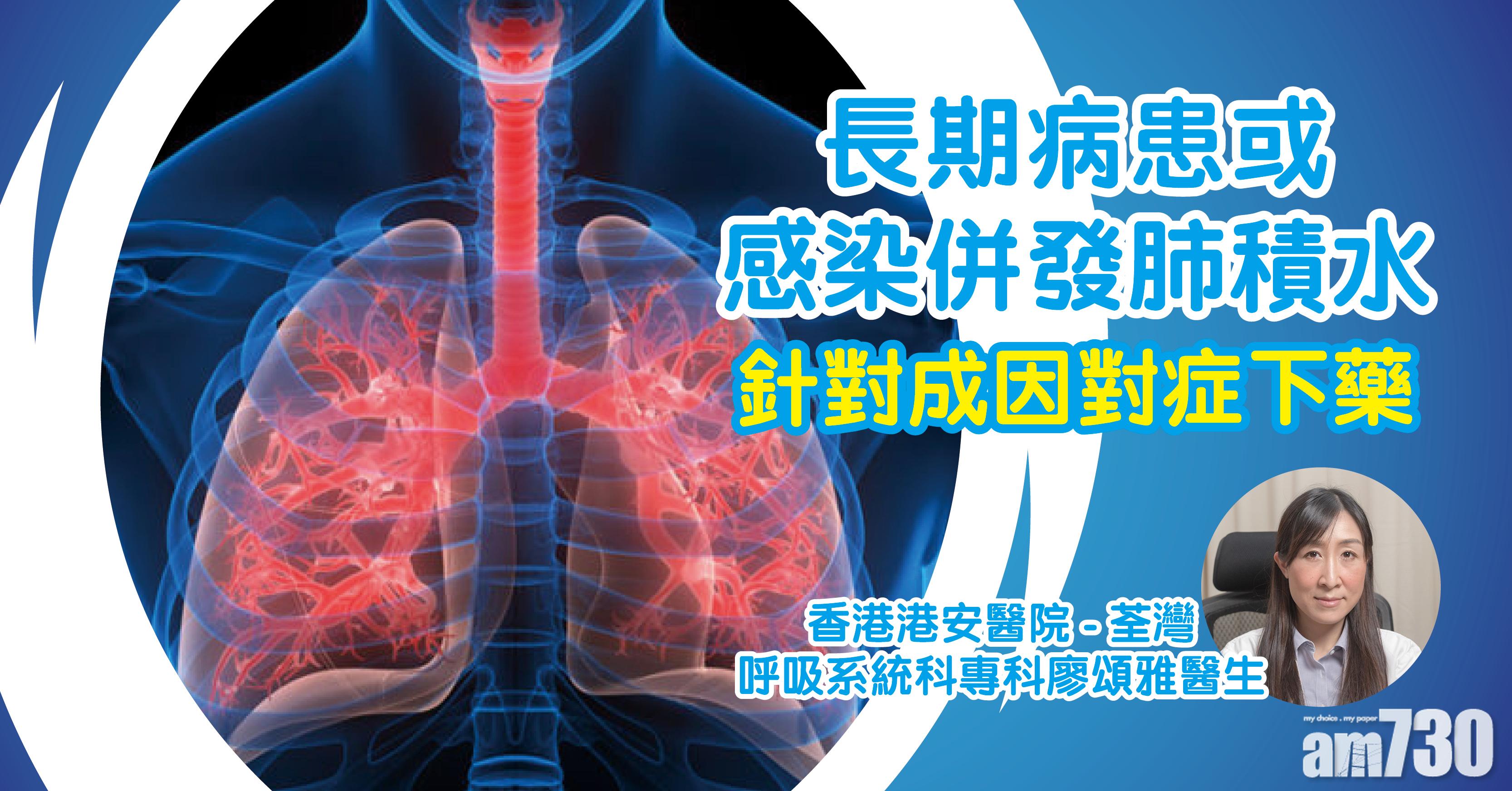 [健康快訊] 長期病患或感染併發肺積水  針對成因對症下藥