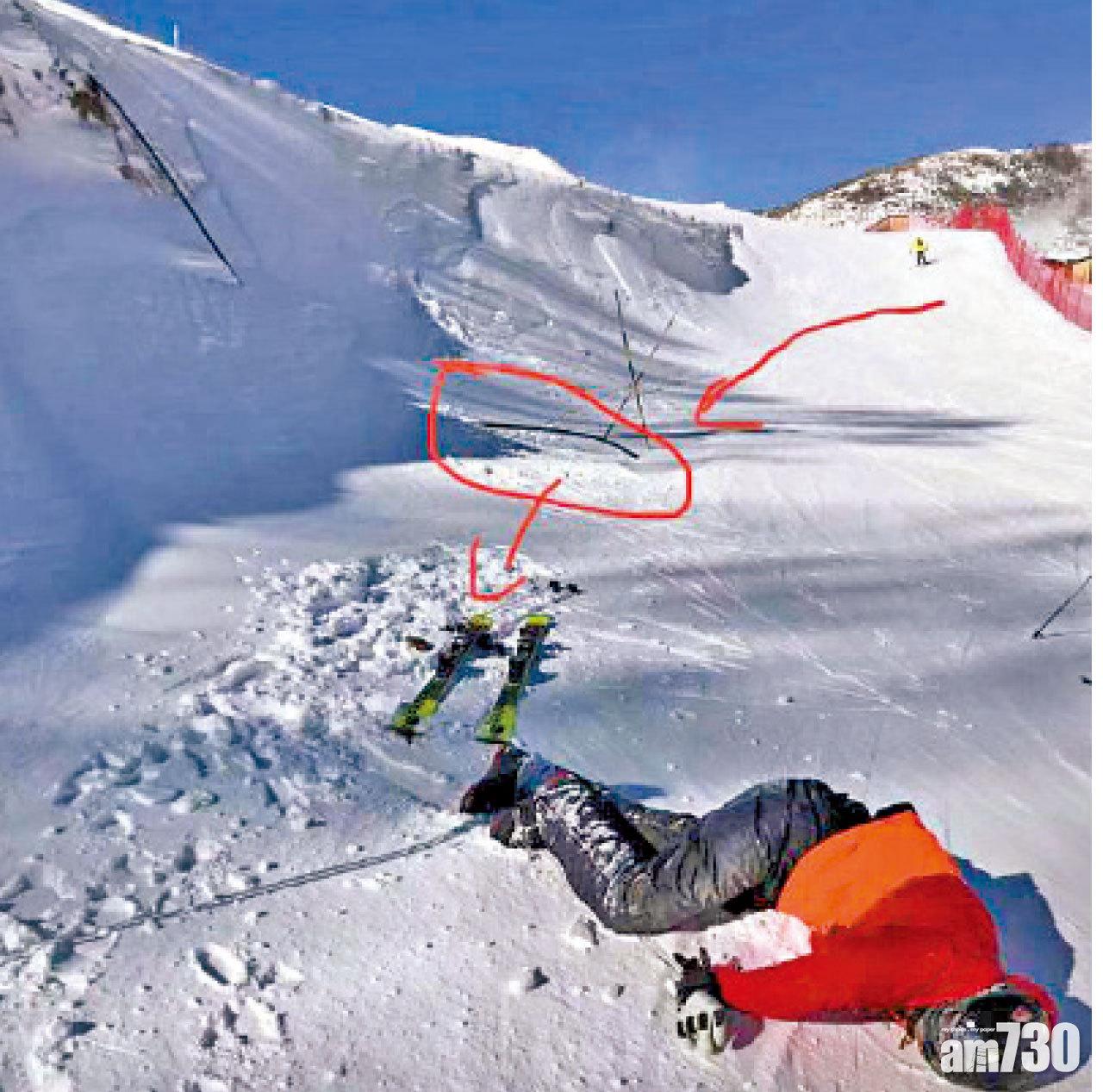 河北雲頂滑雪場雪道露電線 資深滑雪者絆倒不治