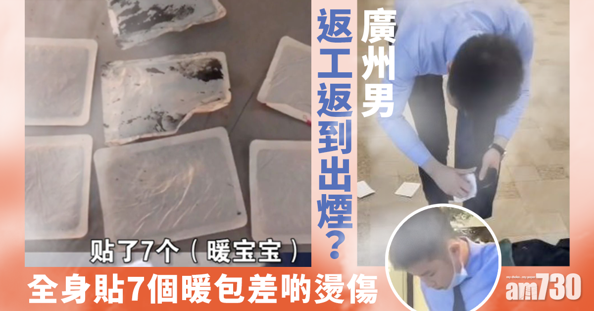 【網上熱話】廣州男返工返到出煙？全身貼7個暖包差啲燙傷