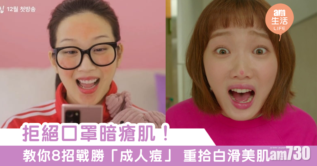 口罩養成暗瘡肌？　8招有效戰勝「成人痘」