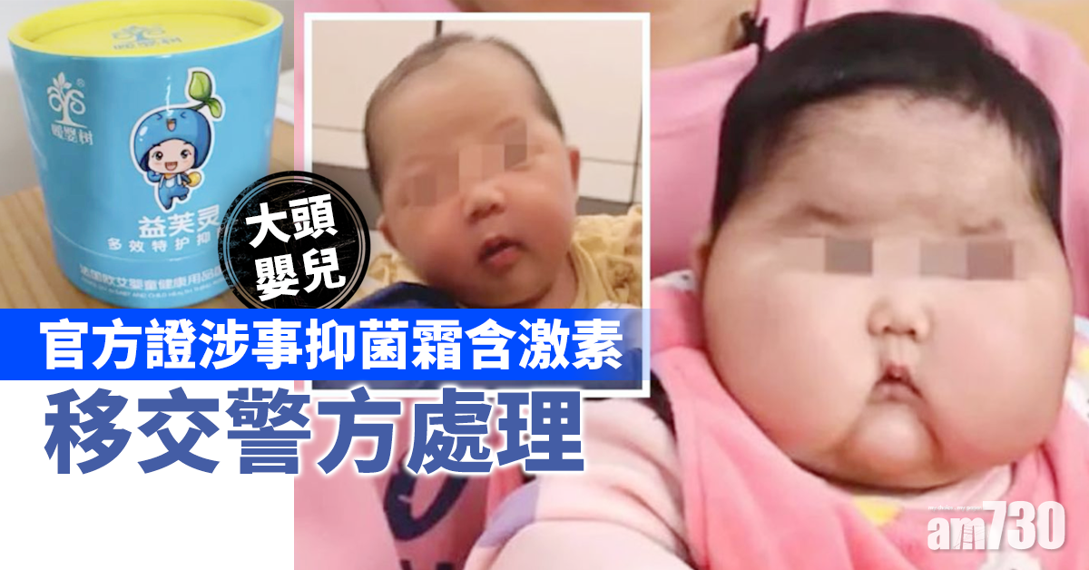 【大頭嬰兒】官方證涉事抑菌霜含激素 移交警方處理