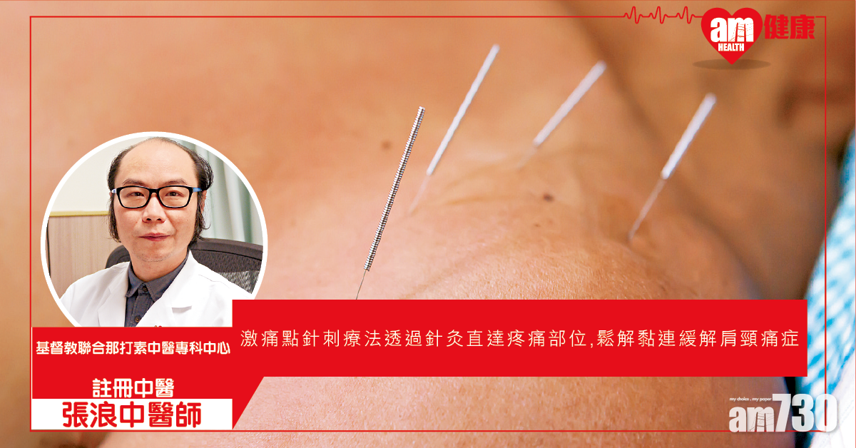 激痛點針刺療法 緩解痛症