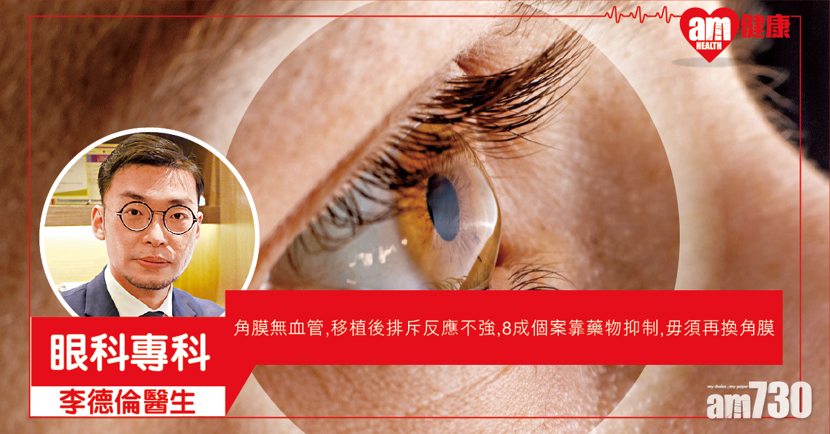 角膜移植 術後護理最重要