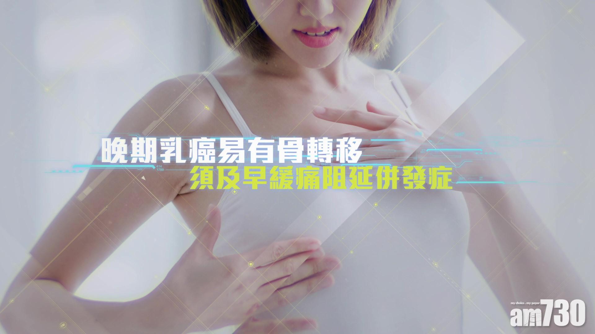 晚期乳癌易有骨轉移 須及早緩痛阻延併發症