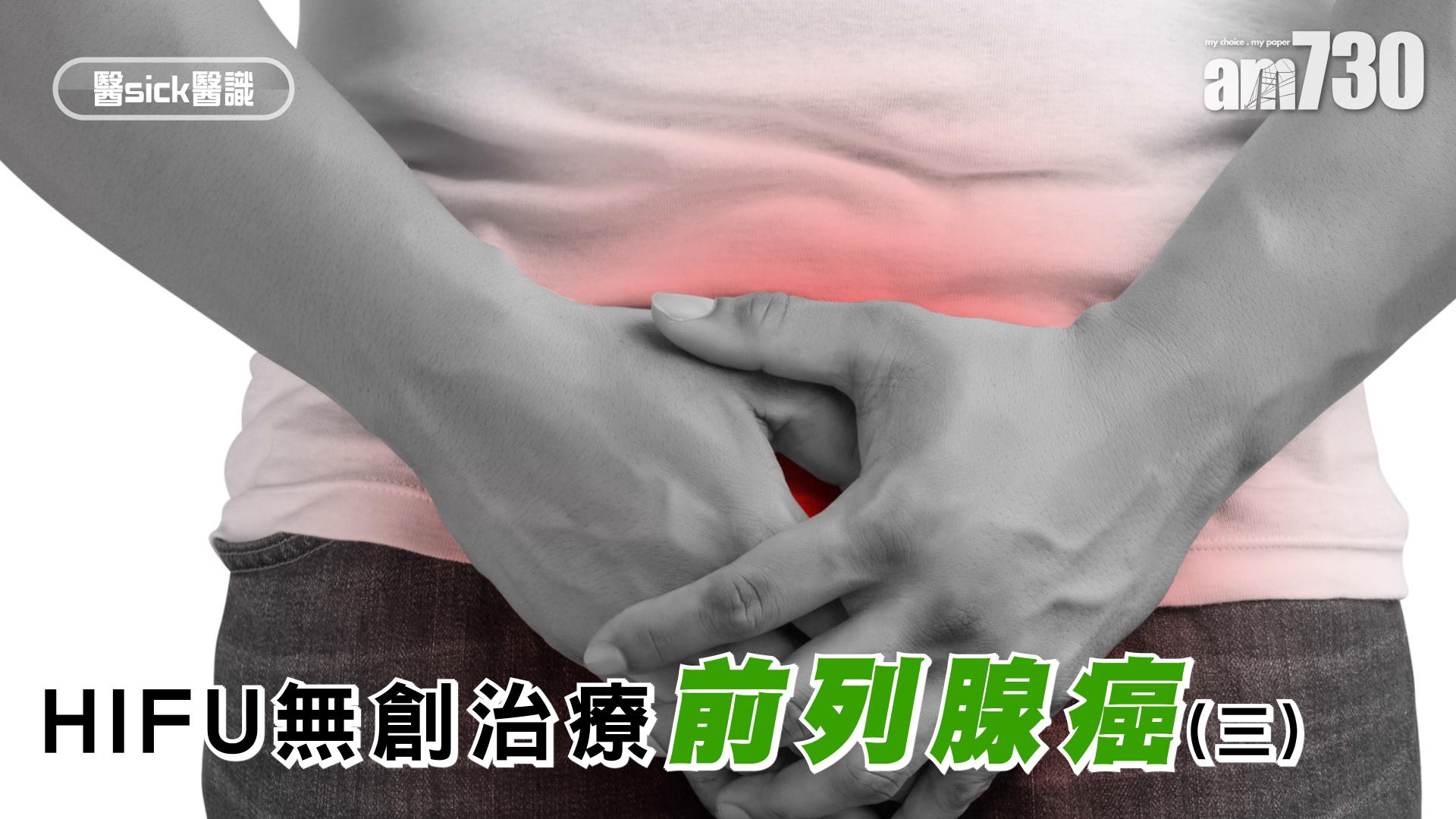 HIFU無創治療前列腺癌(三)