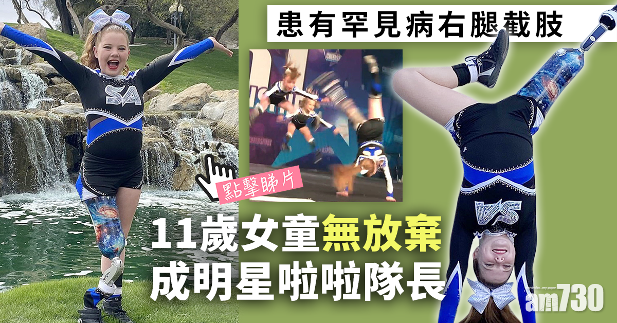 勵志｜嬰兒時右腿截肢 11歲女童無放棄成明星啦啦隊長 (有片)