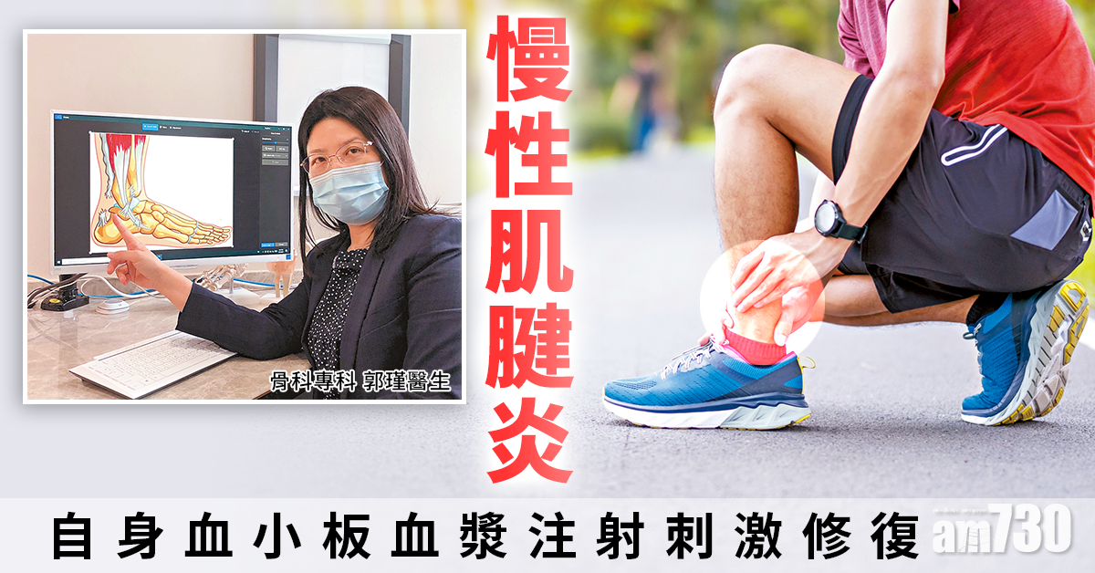 注射濃縮血小板 治療肌腱炎