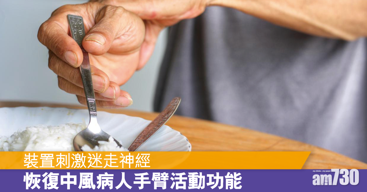 刺激迷走神經 助中風病人恢復手臂功能