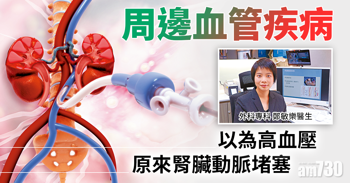 周邊血管疾病 或阻腎臟供血