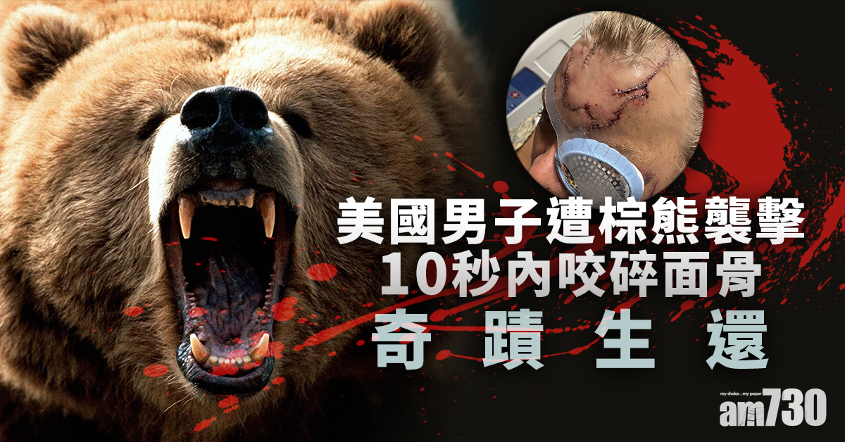 極度驚嚇 10秒突襲 美漢遭棕熊直撲噬面險死