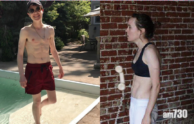 Elliot Page變性手術後首次公開赤裸