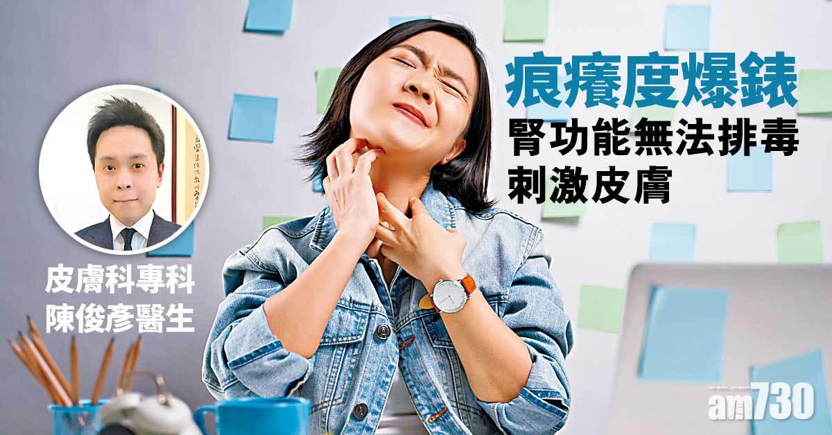 尿毒瘙癢症 全身痕到癲