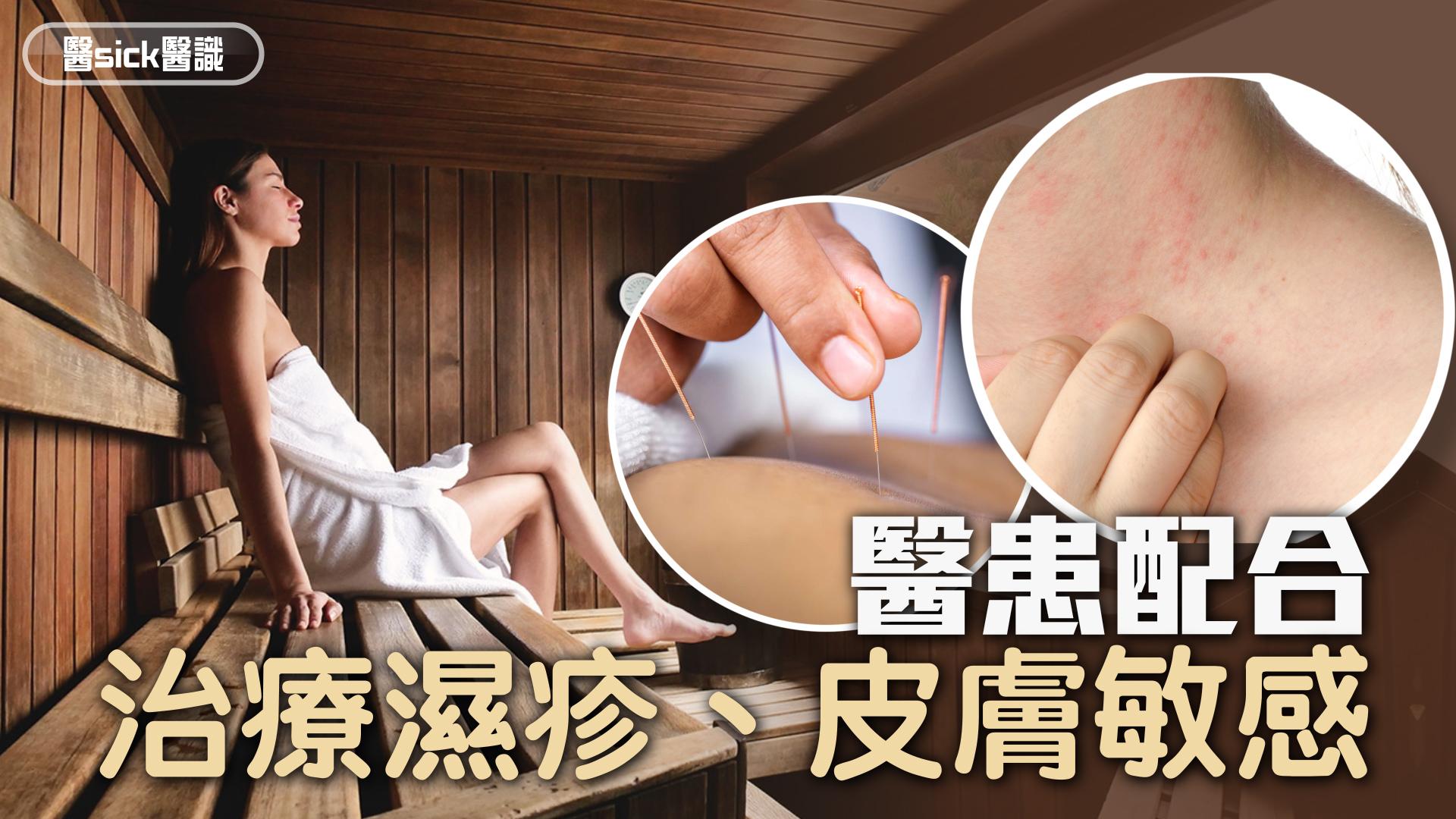 醫患配合 治療濕疹、皮膚敏感