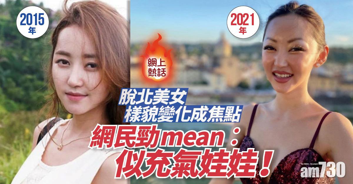 網上熱話｜脫北美女樣貌變化成焦點 網民勁mean︰似充氣娃娃！