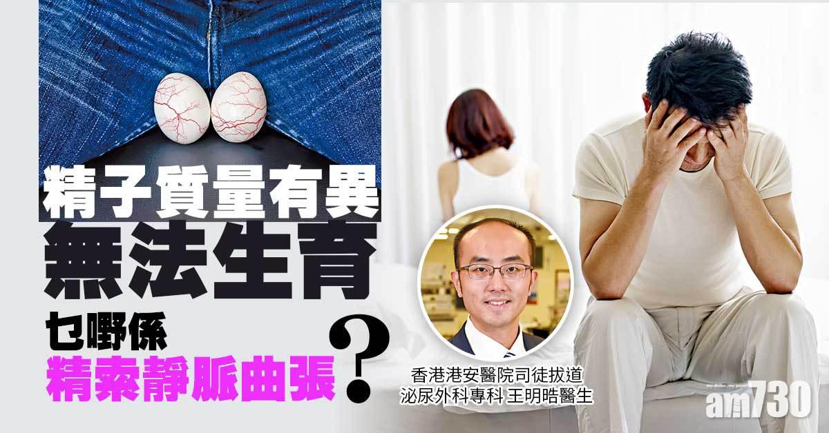 精索靜脈曲張令男士不育