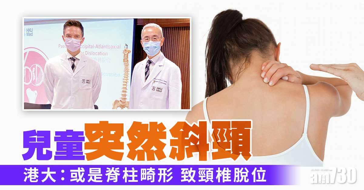 提高警覺 兒童斜頸或患 AARD  OAARD 延醫令神經損傷可致命