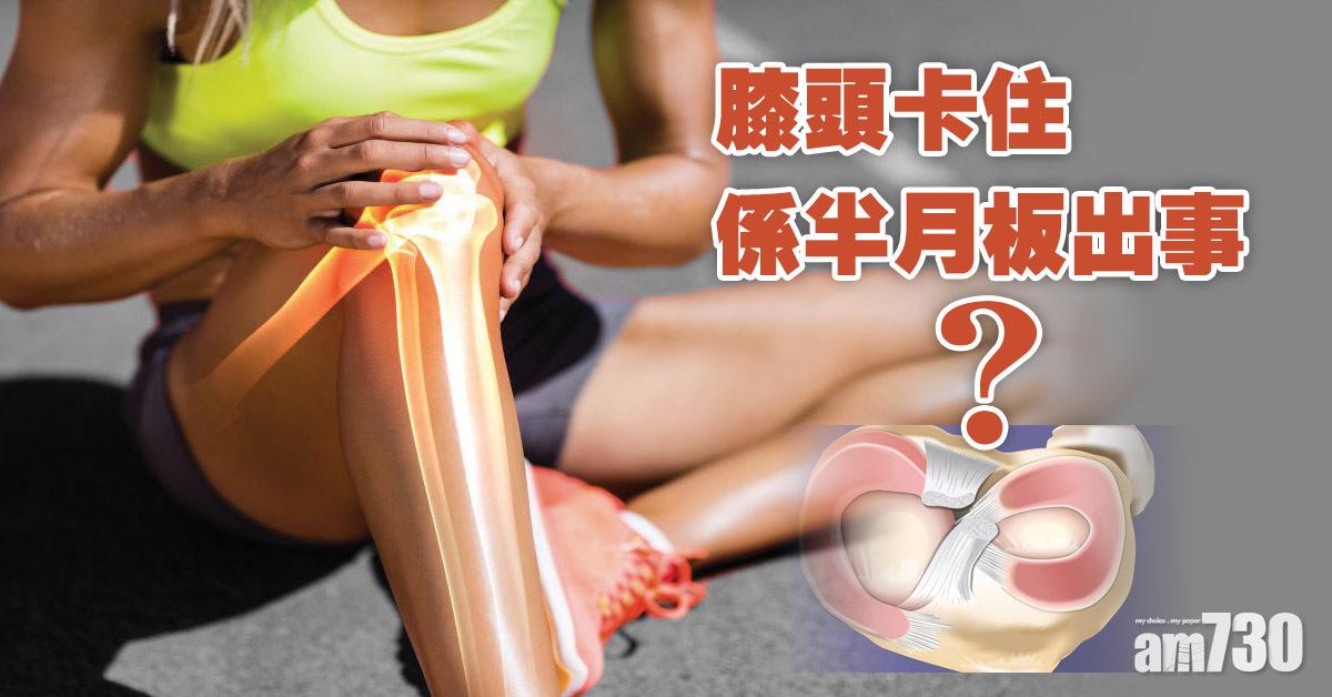 半月板｜3個徵兆代表可能出現撕裂