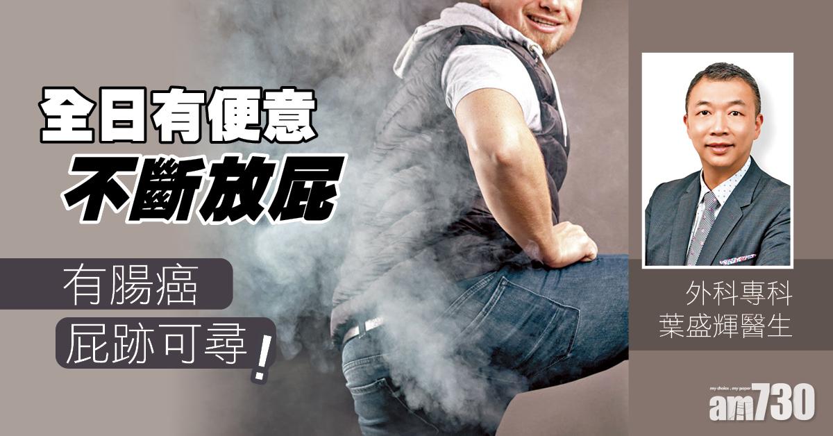 為什麼一直放屁？2大成因你要知 冇屁放可能患上腸癌