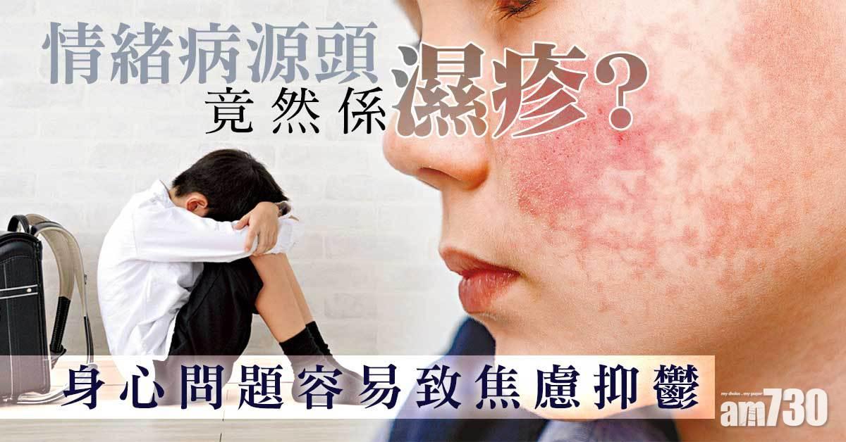 情緒病源頭 竟然係濕疹？
