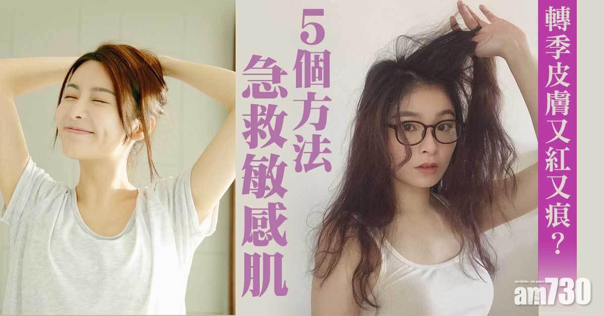 轉季敏感｜皮膚又紅又痕？ 5個方法急救敏感肌