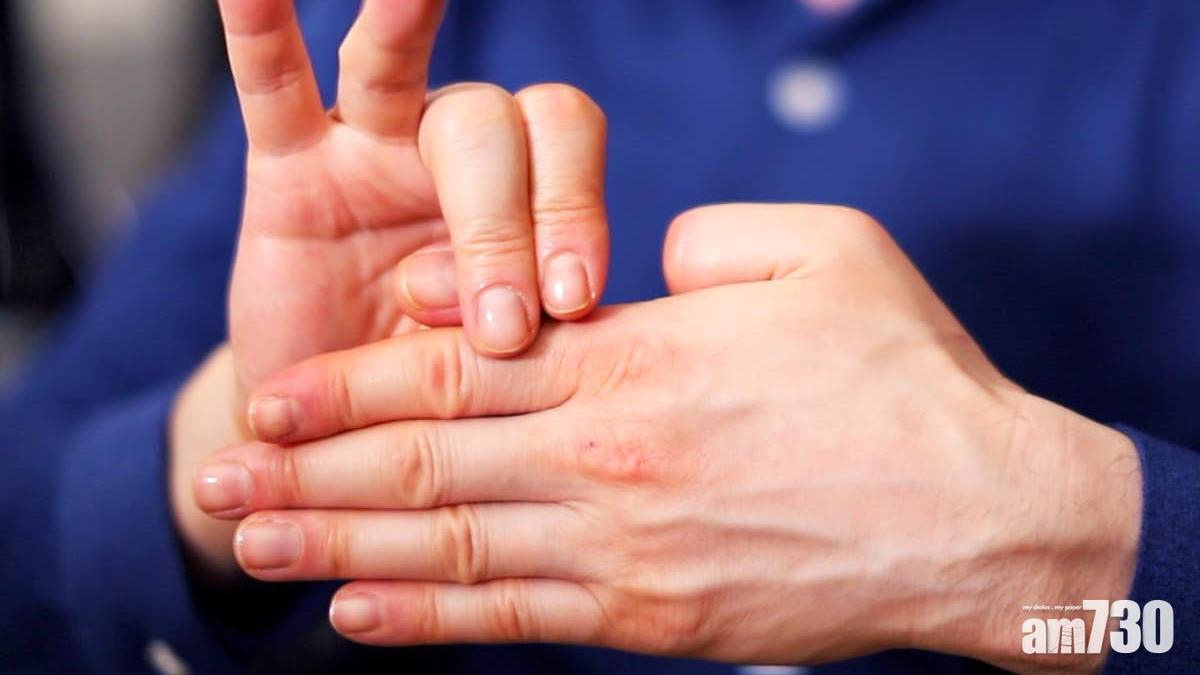 斷指5個步驟處理 手指斷駁得返機會大增