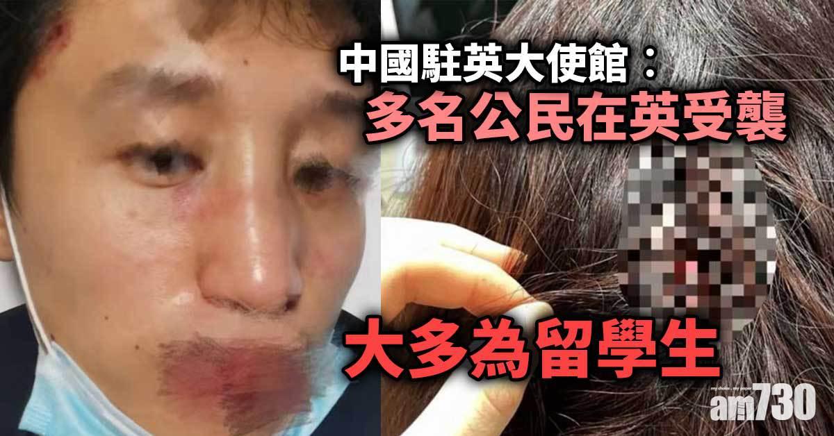 中國駐英大使館︰多名公民在英受襲 促加強防範 內媒稱一周有七八宗