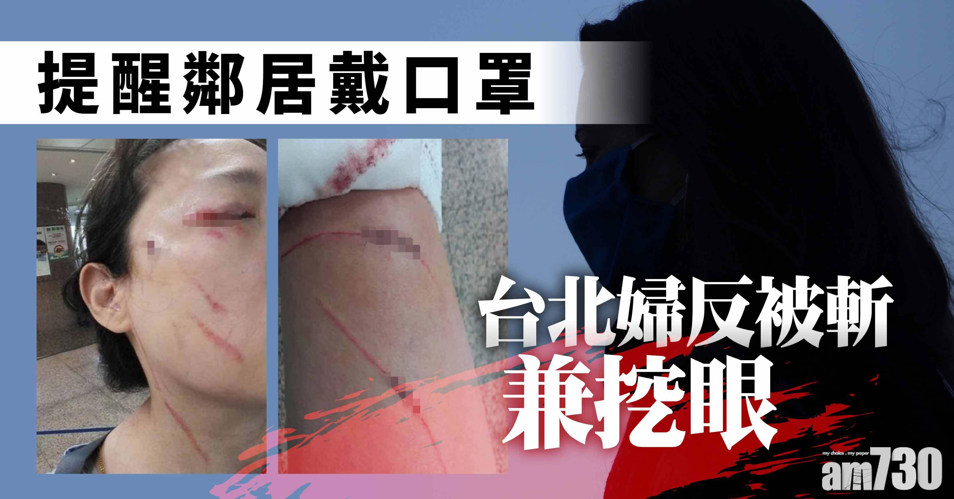提醒鄰居戴口罩 台北婦被斬兼挖眼
