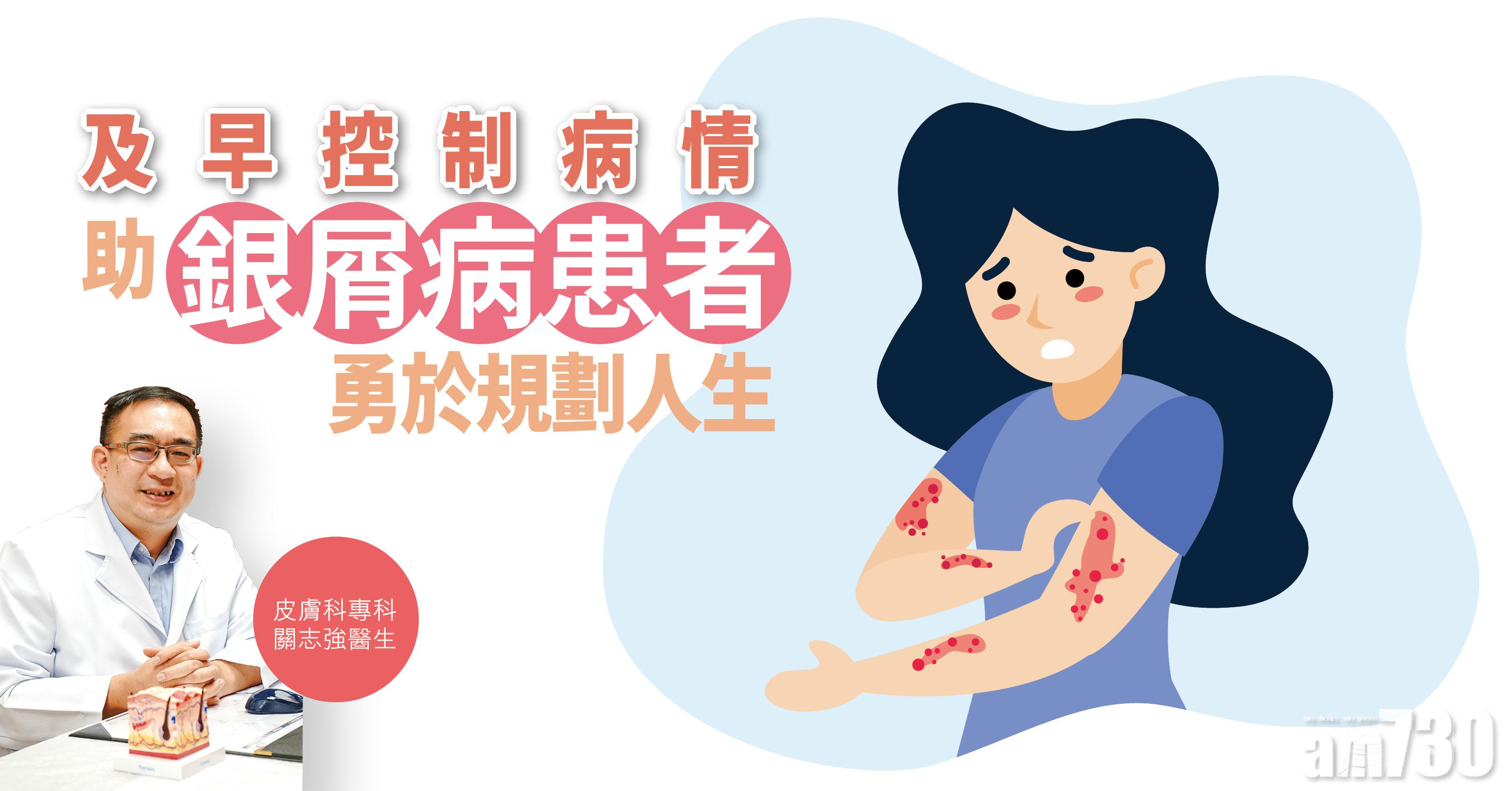 【健康解碼】及早控制病情 助銀屑病患者勇於規劃人生