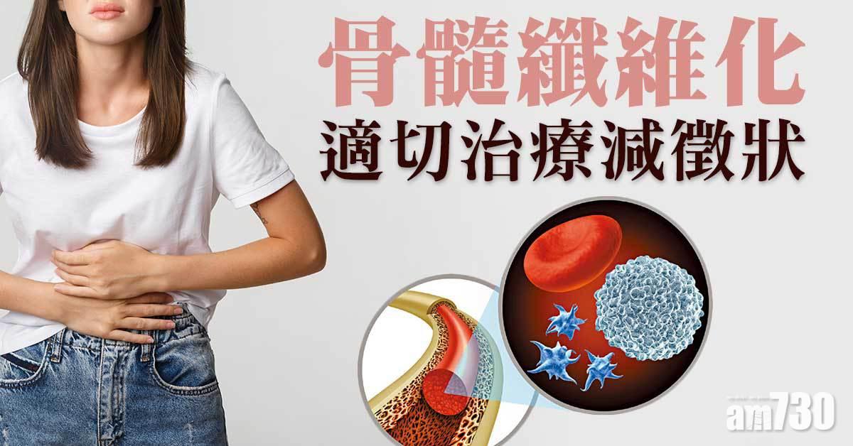 骨髓纖維化 適切治療減徵狀