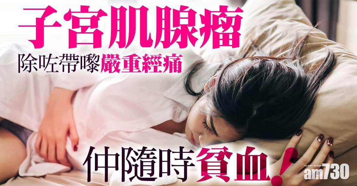 子宮肌腺瘤｜嚴重經痛隨時貧血 治療仲有啲棘手……