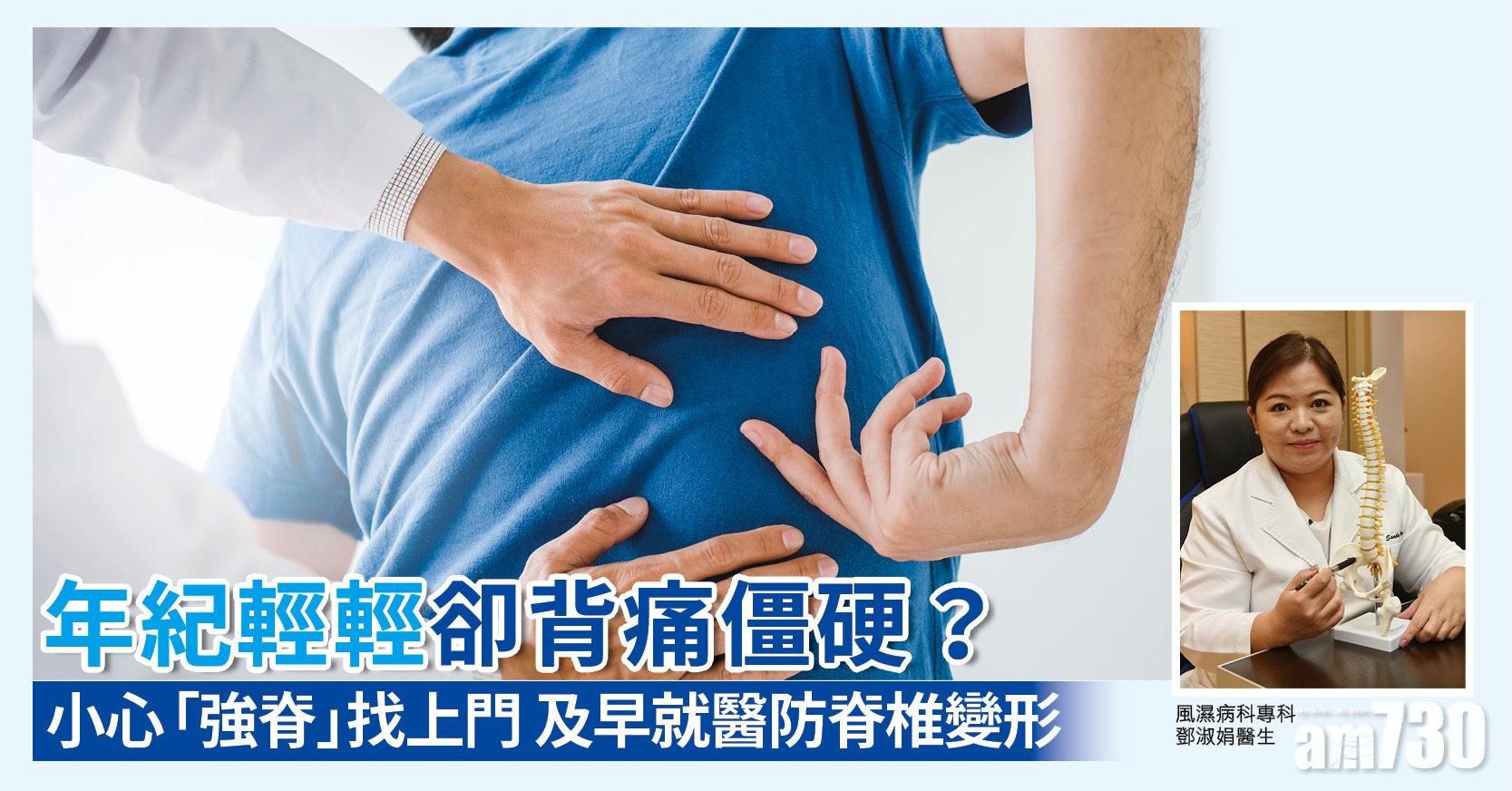 年紀輕輕卻背痛僵硬？小心「強脊」找上門 及早就醫防脊椎變形