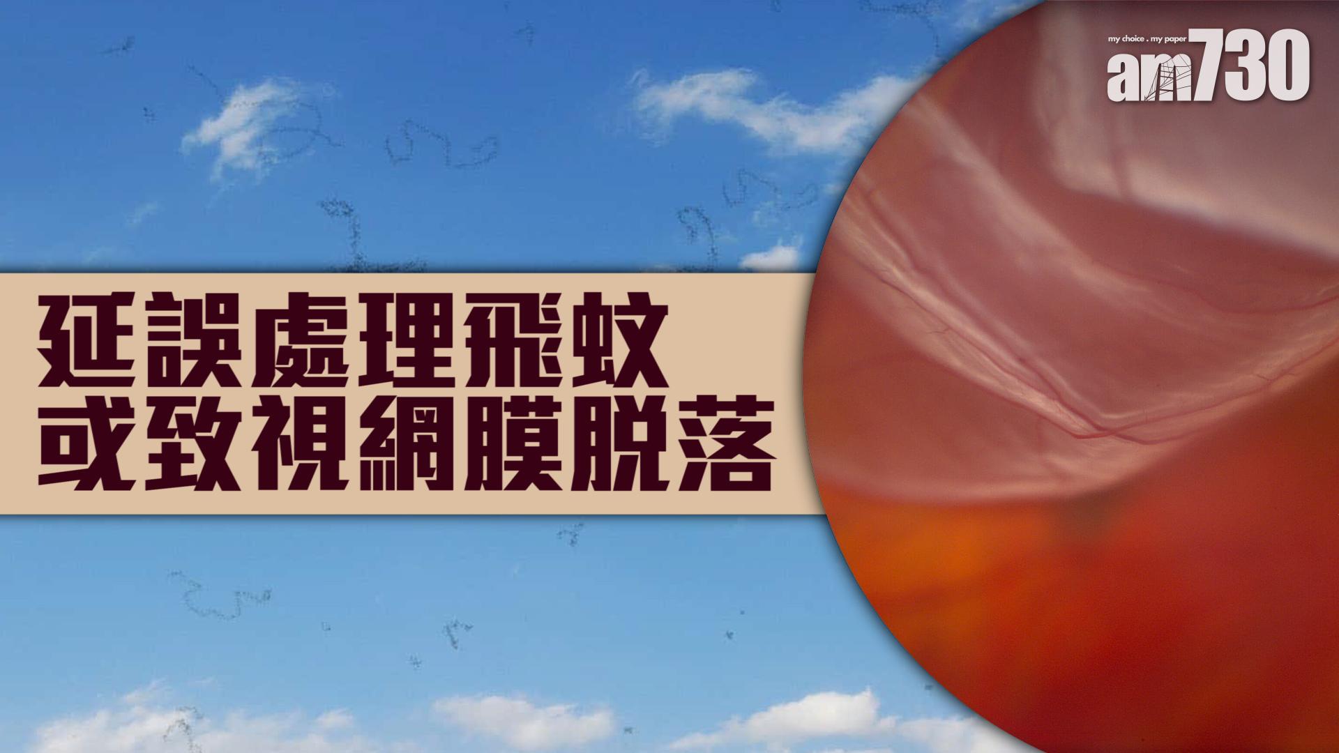 延誤處理飛蚊 或致視網膜脫落